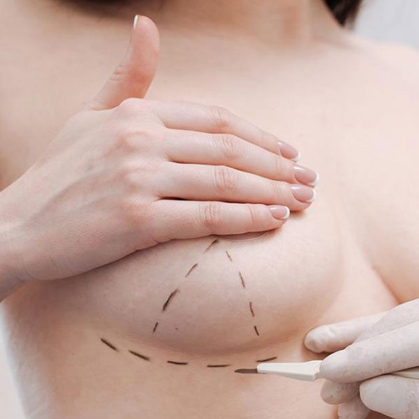 Stillen nach Brustoperation